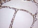 BCL6 Antibody in Immunohistochemistry (Paraffin) (IHC (P))