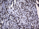 BCL6 Antibody in Immunohistochemistry (Paraffin) (IHC (P))