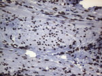 BCL6 Antibody in Immunohistochemistry (Paraffin) (IHC (P))