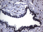 BCL6 Antibody in Immunohistochemistry (Paraffin) (IHC (P))