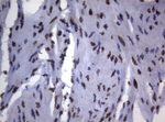 BCL6 Antibody in Immunohistochemistry (Paraffin) (IHC (P))