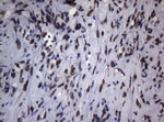 BCL6 Antibody in Immunohistochemistry (Paraffin) (IHC (P))