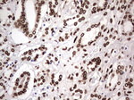 BCL6 Antibody in Immunohistochemistry (Paraffin) (IHC (P))