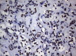 BCL6 Antibody in Immunohistochemistry (Paraffin) (IHC (P))