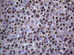 BCL6 Antibody in Immunohistochemistry (Paraffin) (IHC (P))