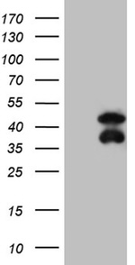 BCL7B Antibody in Western Blot (WB)