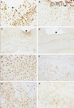 TNF alpha Antibody in Immunohistochemistry (Paraffin) (IHC (P))