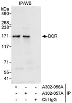 BCR Antibody in Immunoprecipitation (IP)
