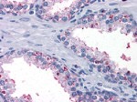 BDH1 Antibody in Immunohistochemistry (Paraffin) (IHC (P))