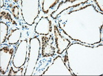 BDH2 Antibody in Immunohistochemistry (Paraffin) (IHC (P))