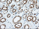 BDH2 Antibody in Immunohistochemistry (Paraffin) (IHC (P))