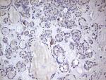 BFSP1 Antibody in Immunohistochemistry (Paraffin) (IHC (P))