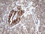 BFSP1 Antibody in Immunohistochemistry (Paraffin) (IHC (P))