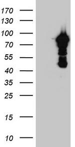 BFSP1 Antibody in Western Blot (WB)