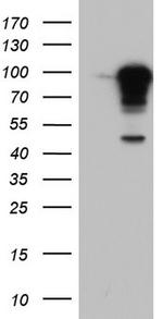 BFSP1 Antibody in Western Blot (WB)