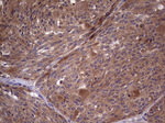 BFSP2 Antibody in Immunohistochemistry (Paraffin) (IHC (P))