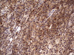 BFSP2 Antibody in Immunohistochemistry (Paraffin) (IHC (P))