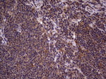 BFSP2 Antibody in Immunohistochemistry (Paraffin) (IHC (P))