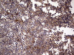 BFSP2 Antibody in Immunohistochemistry (Paraffin) (IHC (P))