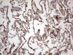 BFSP2 Antibody in Immunohistochemistry (Paraffin) (IHC (P))