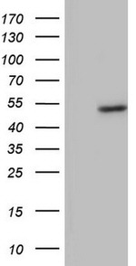 BFSP2 Antibody in Western Blot (WB)