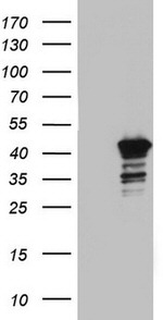 BFSP2 Antibody in Western Blot (WB)