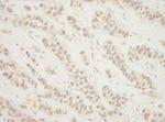 BHD Antibody in Immunohistochemistry (IHC)