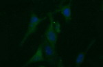 BID Antibody in Immunocytochemistry (ICC/IF)