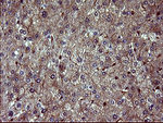 BID Antibody in Immunohistochemistry (Paraffin) (IHC (P))