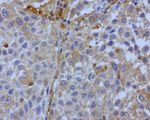 BID Antibody in Immunohistochemistry (Paraffin) (IHC (P))