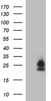 BID Antibody in Western Blot (WB)