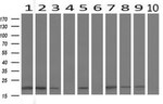 BID Antibody in Western Blot (WB)