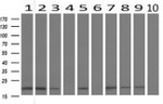 BID Antibody in Western Blot (WB)