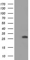 BIN3 Antibody in Western Blot (WB)