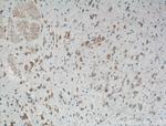 PKM1 Antibody in Immunohistochemistry (Paraffin) (IHC (P))