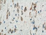 PKM1 Antibody in Immunohistochemistry (Paraffin) (IHC (P))