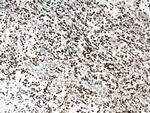 PCNA Antibody in Immunohistochemistry (Paraffin) (IHC (P))