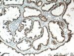 PAX8 Antibody in Immunohistochemistry (Paraffin) (IHC (P))