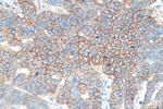 CD9 Antibody in Immunohistochemistry (Paraffin) (IHC (P))