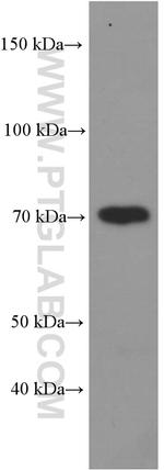 OPTN Antibody in Western Blot (WB)