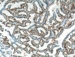 PR Antibody in Immunohistochemistry (Paraffin) (IHC (P))