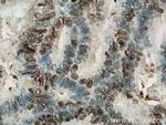 PR Antibody in Immunohistochemistry (Paraffin) (IHC (P))