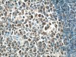 BCL6 Antibody in Immunohistochemistry (Paraffin) (IHC (P))