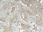 P-cadherin Antibody in Immunohistochemistry (Paraffin) (IHC (P))