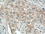 P-cadherin Antibody in Immunohistochemistry (Paraffin) (IHC (P))