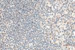 CXCR4 Antibody in Immunohistochemistry (Paraffin) (IHC (P))