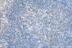 CXCR4 Antibody in Immunohistochemistry (Paraffin) (IHC (P))