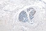 CXCR4 Antibody in Immunohistochemistry (Paraffin) (IHC (P))