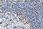 Vimentin Antibody in Immunohistochemistry (Paraffin) (IHC (P))