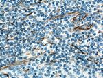 Vimentin Antibody in Immunohistochemistry (Paraffin) (IHC (P))